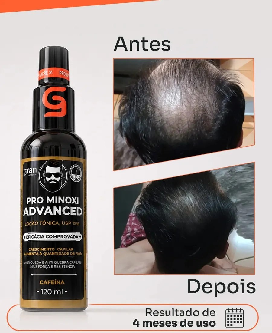CALVO NUNCA MAIS
